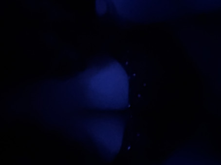 Reagen , 18, United Kingdom