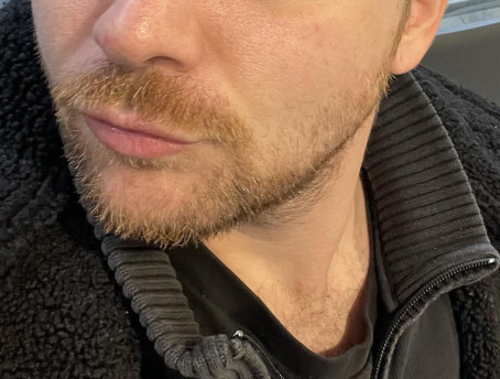 Mr D, 33, United Kingdom