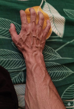 Hussain, 25, India