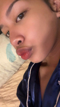 Nyxx, 18, Philippines