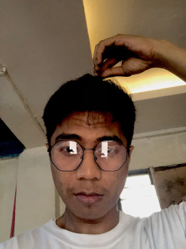 Marklester Asenita, 28, Philippines