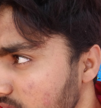 Shoyab Khan, 22, India