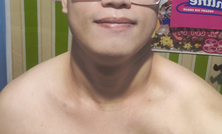 Mark Lester Guevarra, 24, Philippines