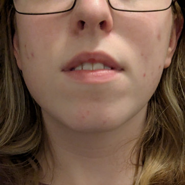 Faith, 18, United States