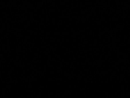 Suzy Gnzls, 18, Philippines