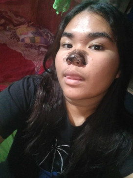 Sandy Dioquino, 18, Philippines