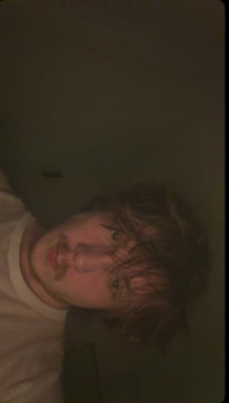 Snap Burn, 18, United States