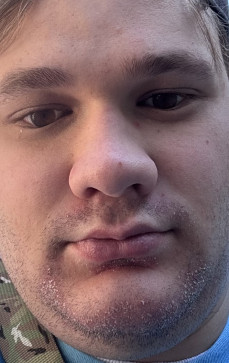 Dakota Adkins, 26, United States