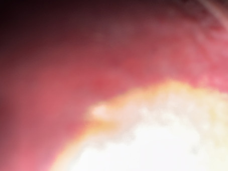 Eduardo Soto Navarro, 18, Mexico