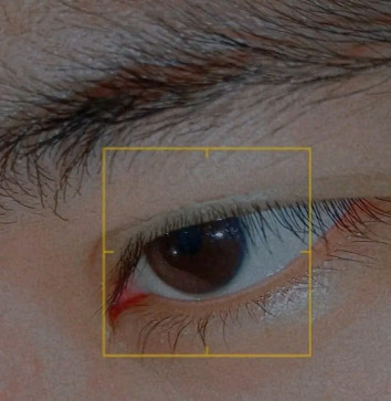 FtMTransgender, 99, Philippines