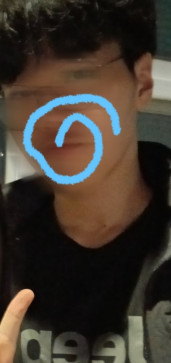 , 18, South Korea