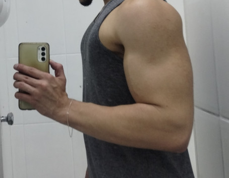 IgrRJ, 22, Brazil