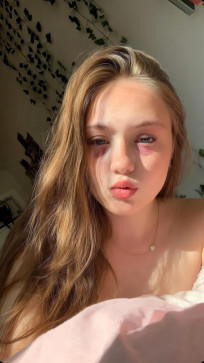 Chloe, 18, United States