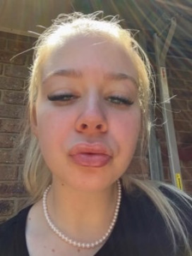 Susan Roberts, 30, Canada