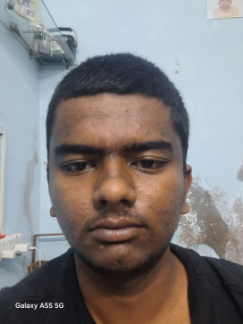 Vinod Suthar, 18, India