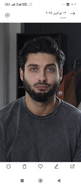   , 28, Turkey