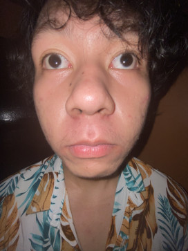 Jayr Maturan, 18, Philippines