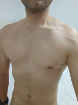 Mdbrg, 21, Tunisia
