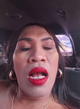 Kugmo, 20, Philippines